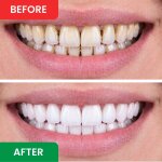 DentaSonic image