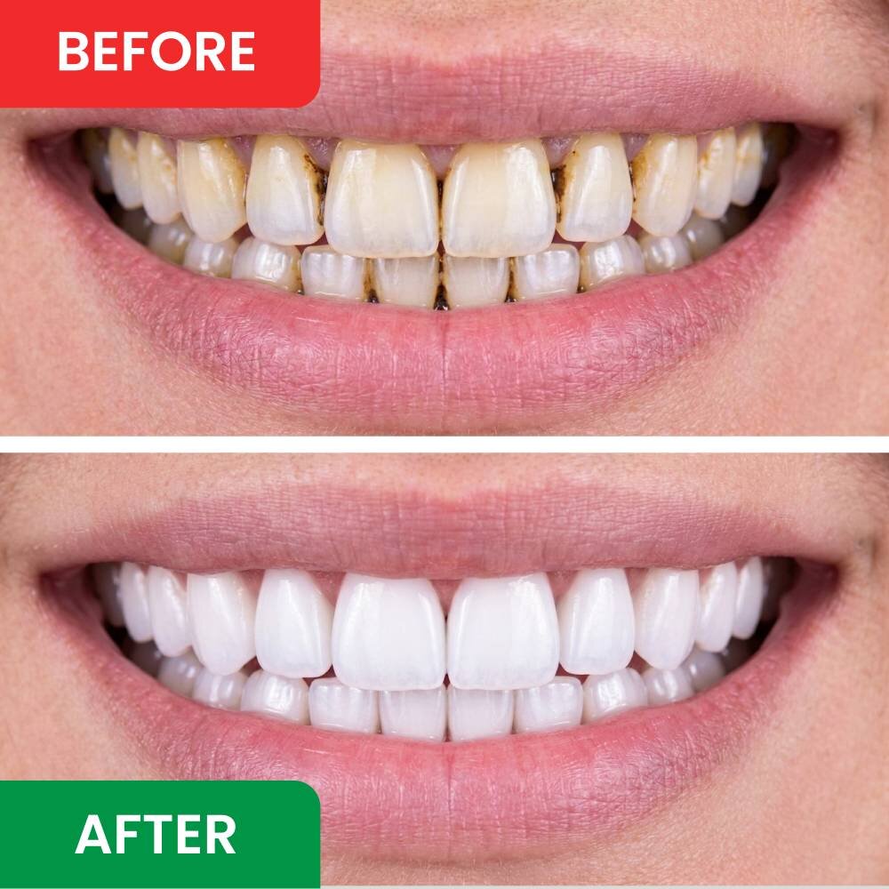 DentaSonic image