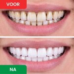DentaSonic image