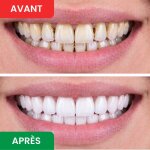 DentaSonic image
