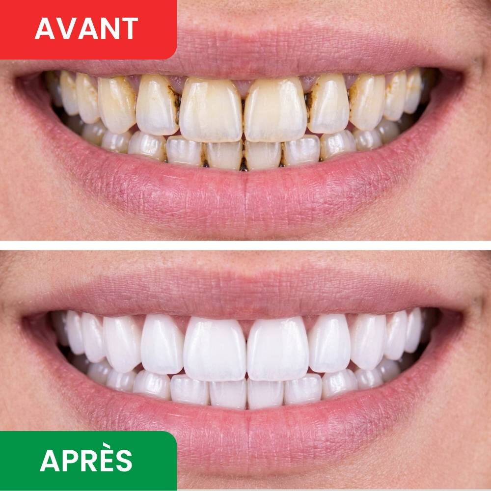 DentaSonic image