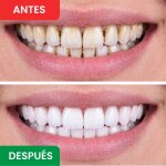 DentaSonic image