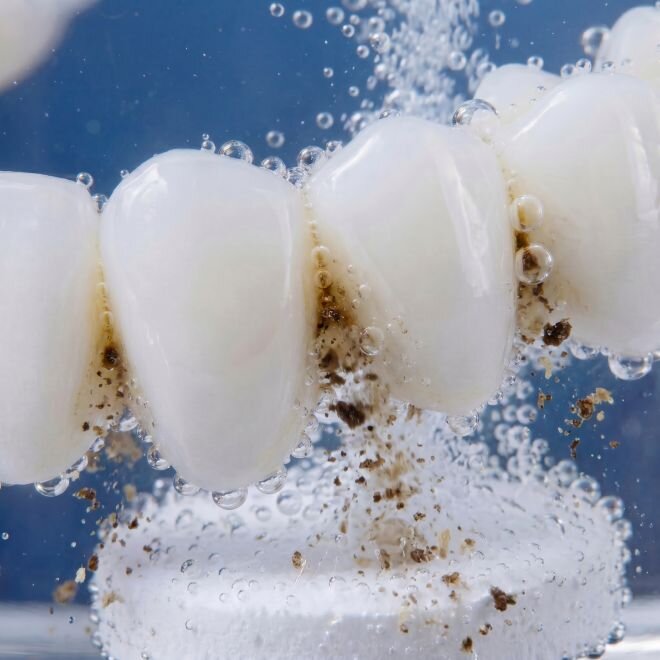DentaSonic image