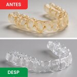 DentaSonic image